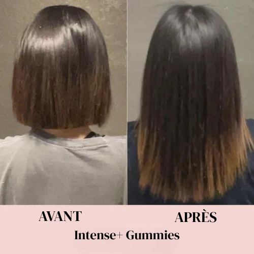 Gummies à la Biotine