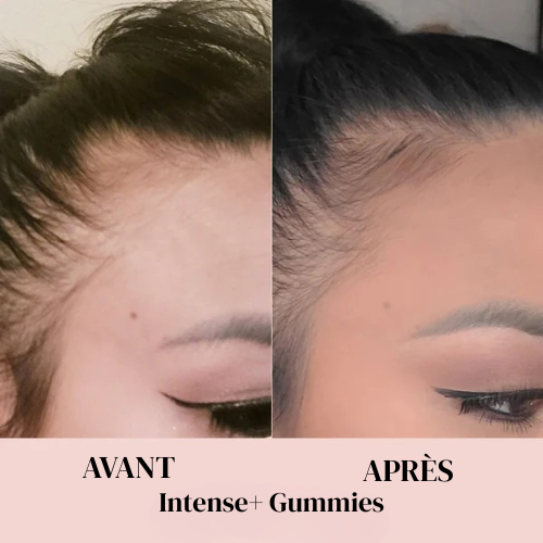 Gummies à la Biotine
