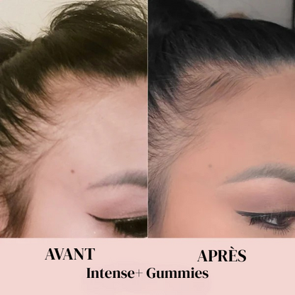 Gummies à la Biotine