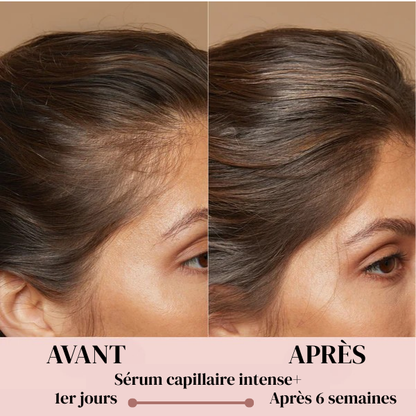 Sérum Capillaire Intense+
