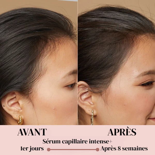 Sérum Capillaire Intense+