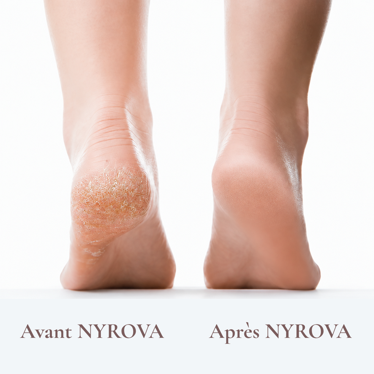 NYROVA SilkFoot Pro V3